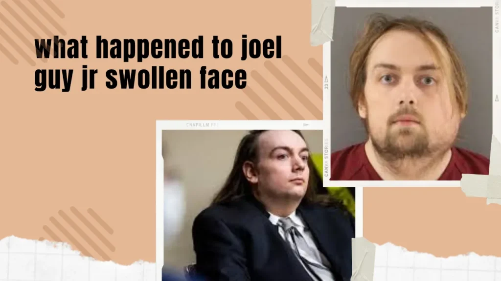 what happened to joel guy jr swollen face