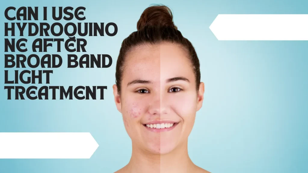 can i use hydroquinone after broad band light treatment