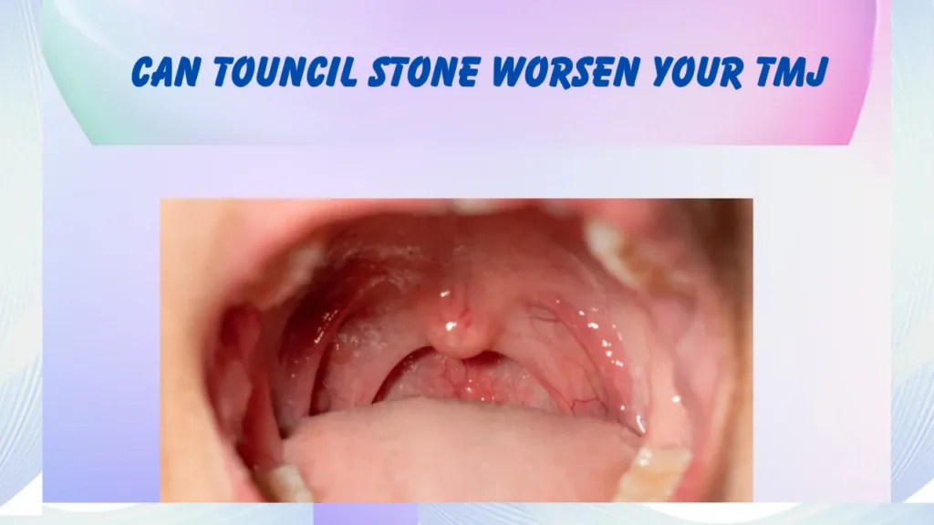 can touncil stone worsen your tmj