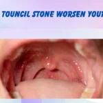 can touncil stone worsen your tmj