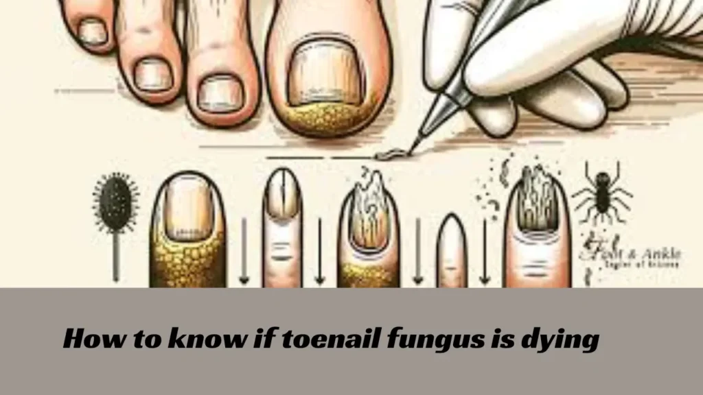 how to know if toenail fungus is dying