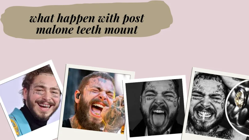 what happen with post malone teeth mount