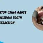 when to stop using gauze after wisdom tooth extraction